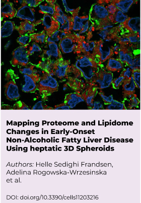 06-Mapping-Proteome-and-Lipidome
