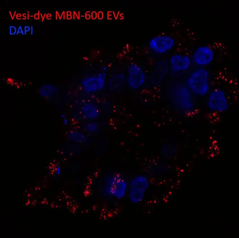 Vesi-Dye-LMB-600-EVs-and-DAPI