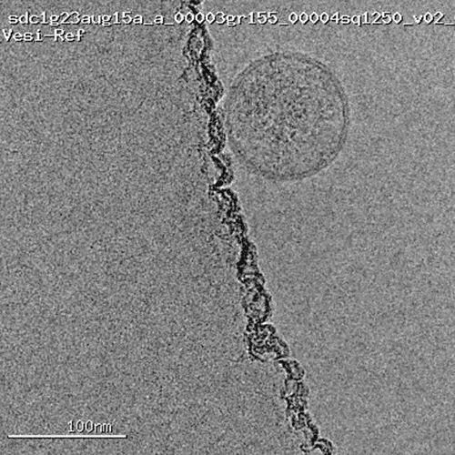 Vesi-Ref-CD63-GFP-Cryo-TEM-August-2023