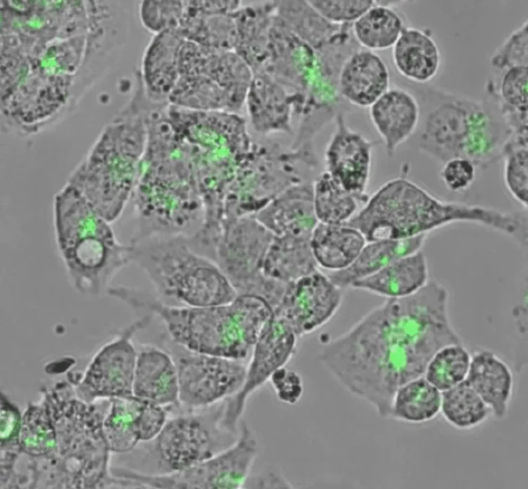 Vesi-Ref-CD63-GFP-cell-tracking